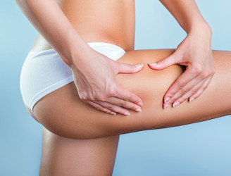 Cellulite Treatment